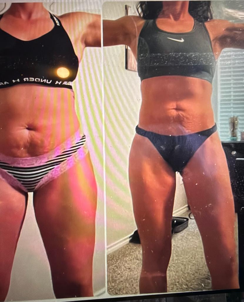Patient transformation result 10 — Fós Wellness weight loss program