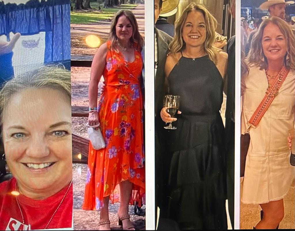 Patient transformation result 11 — Fós Wellness weight loss program