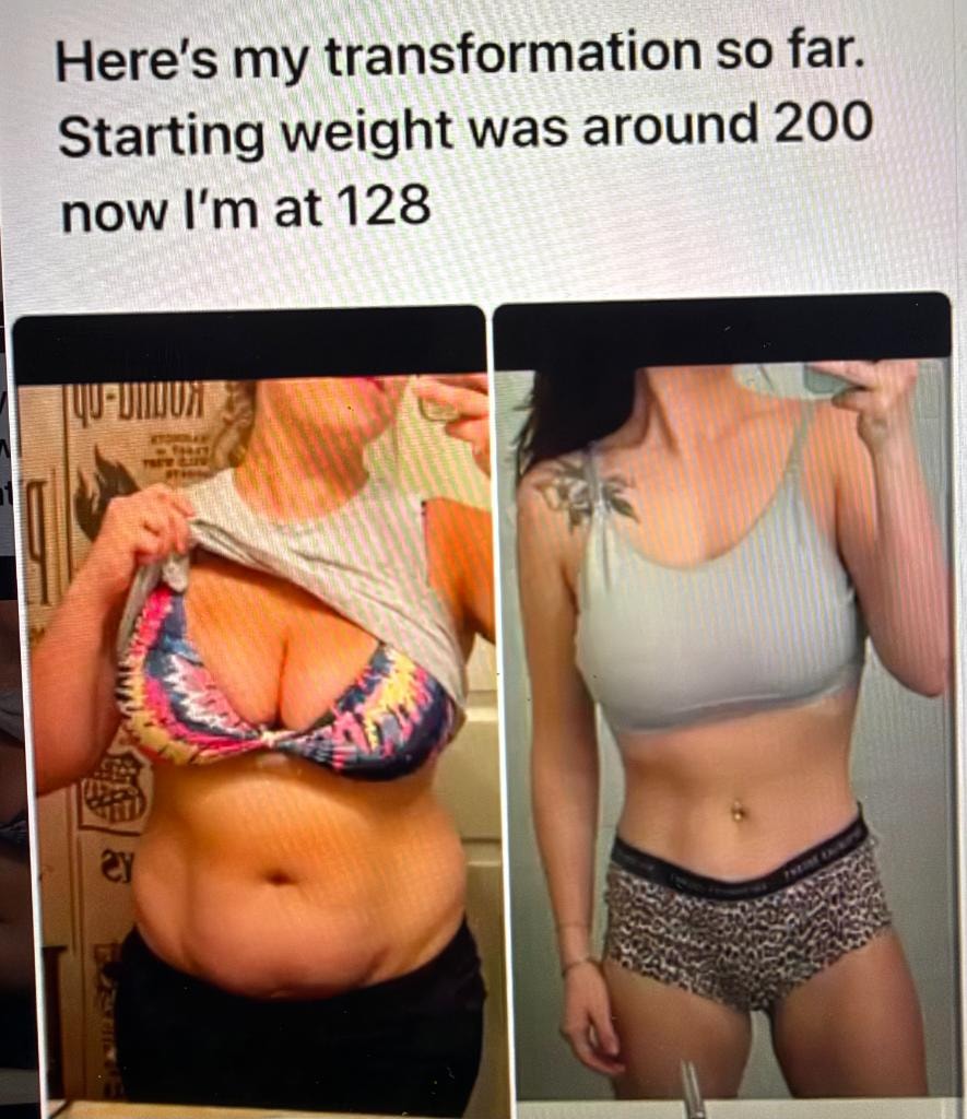 Patient transformation result 14 — Fós Wellness weight loss program