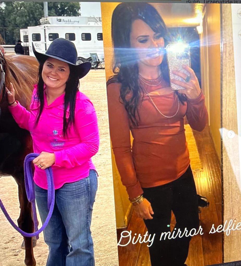 Patient transformation result 15 — Fós Wellness weight loss program