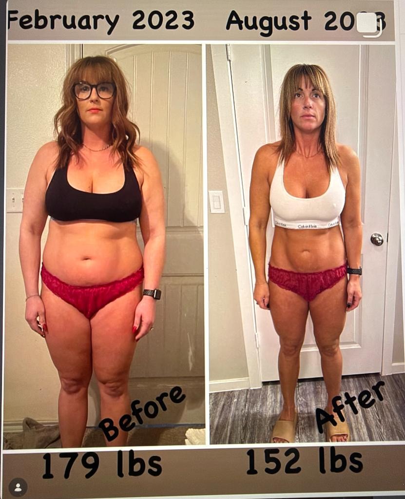 Patient transformation result 5 — Fós Wellness weight loss program