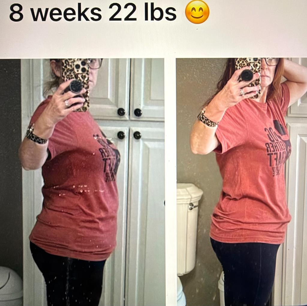 Patient transformation result 7 — Fós Wellness weight loss program