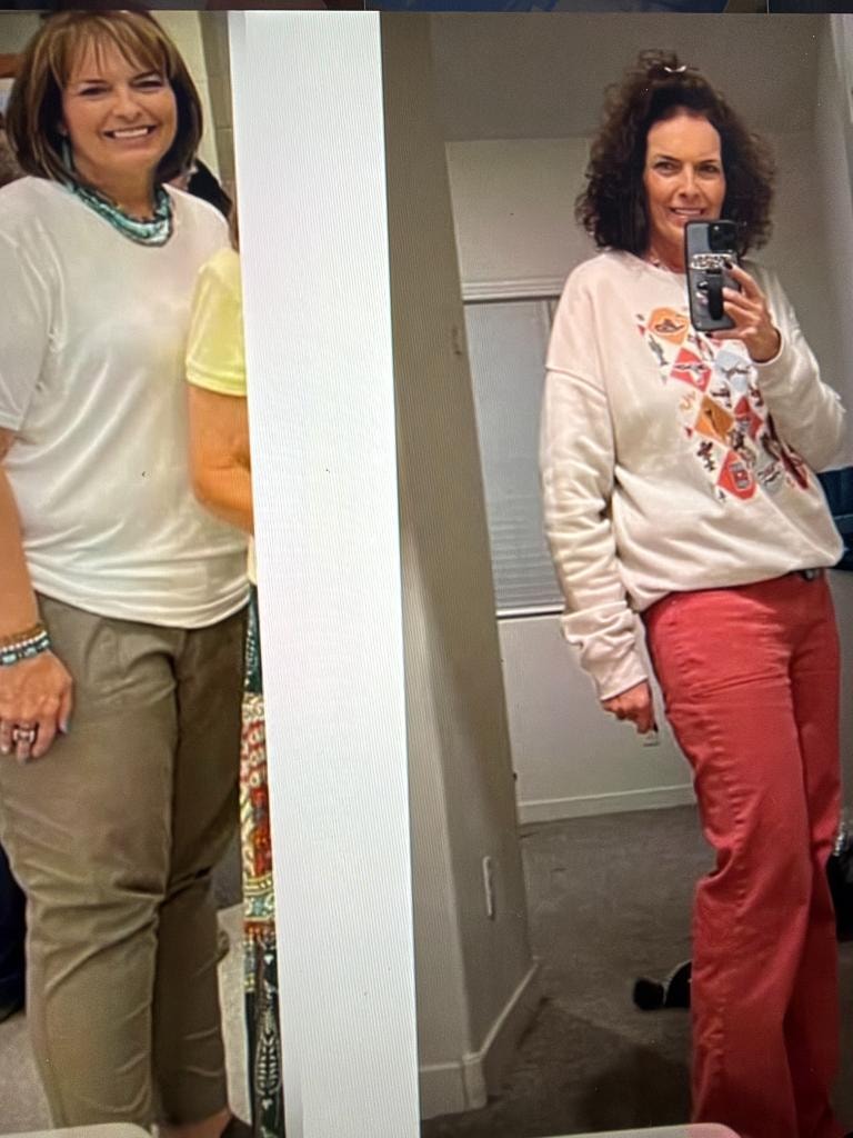 Patient transformation result 9 — Fós Wellness weight loss program